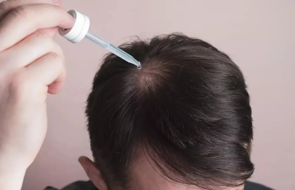 Minoxidil